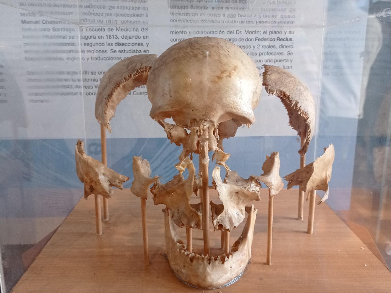 Cráneo humano desarmado, expuesto dentro de una vitrina