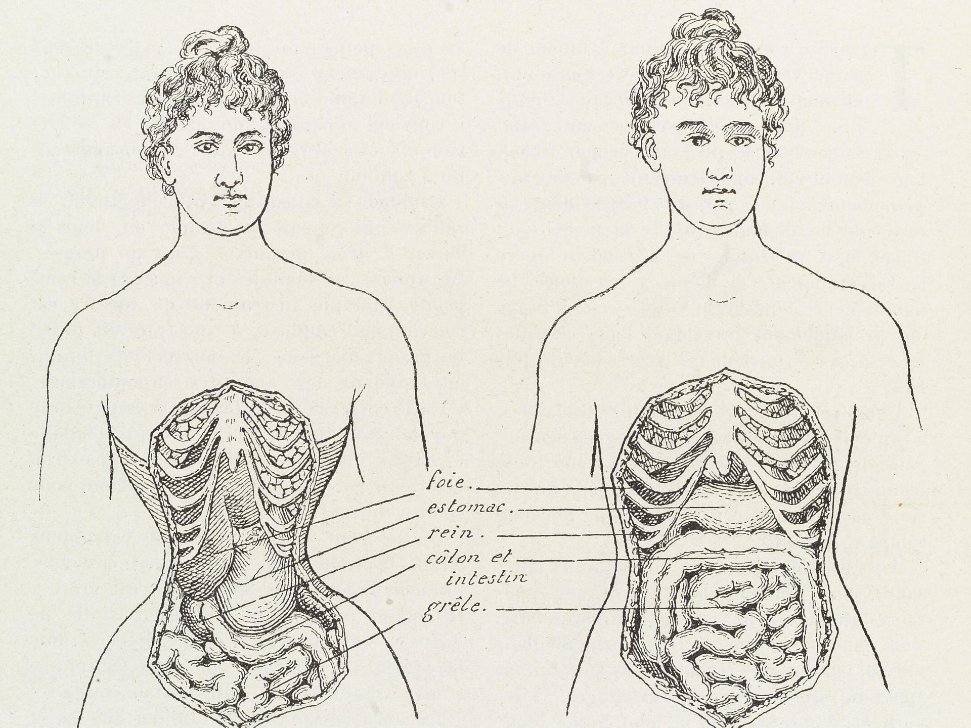 ilustración anatómica de utilización corset